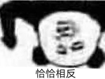 日本小哥手指腫得像乒乓球：結果被他解鎖了先天洗頭圣體！