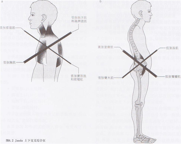 比散步還簡單的動作！每天只需10分鐘 就能改善體態、緩解肩頸痛