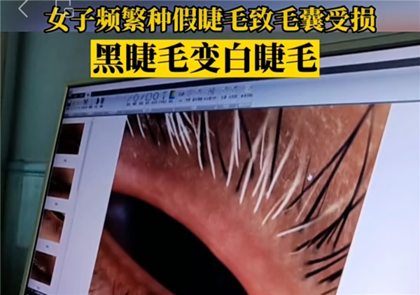 那些總戴假睫毛的人：現在都怎么樣了