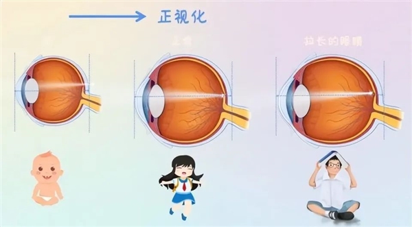 近視的人老之后：是視力逐漸變好 還是同時老花眼