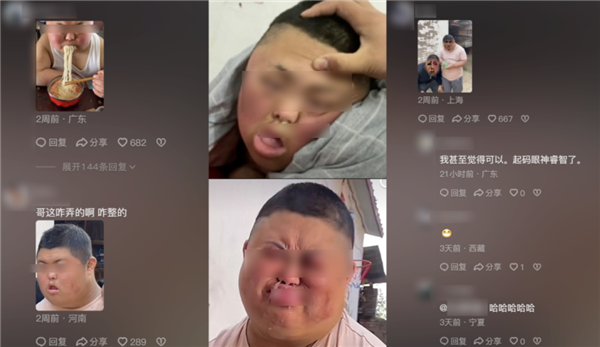 現(xiàn)代“人血饅頭”：唐氏綜合征成取笑樂子、病痛成流量密碼