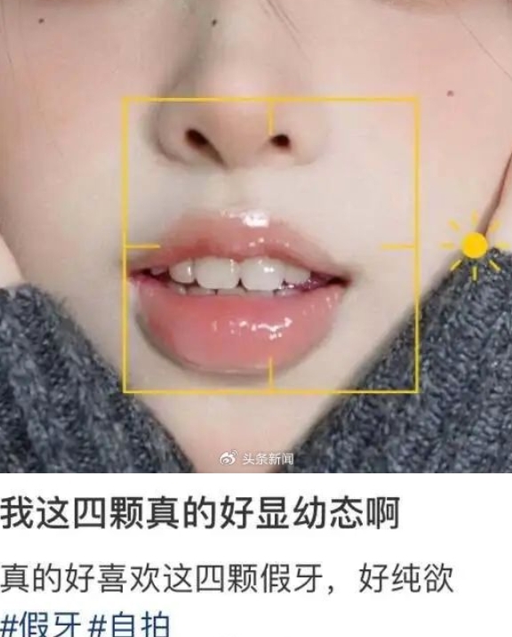 幼態審美盯上女生的牙齒：寶寶碗、寶寶針之后 寶寶牙也來了