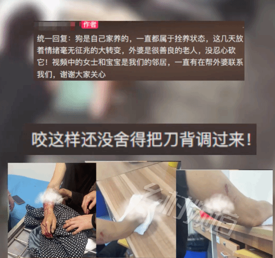 老人手臂被家養(yǎng)狗撕咬：手中握刀不舍得砍 網(wǎng)友唏噓不已